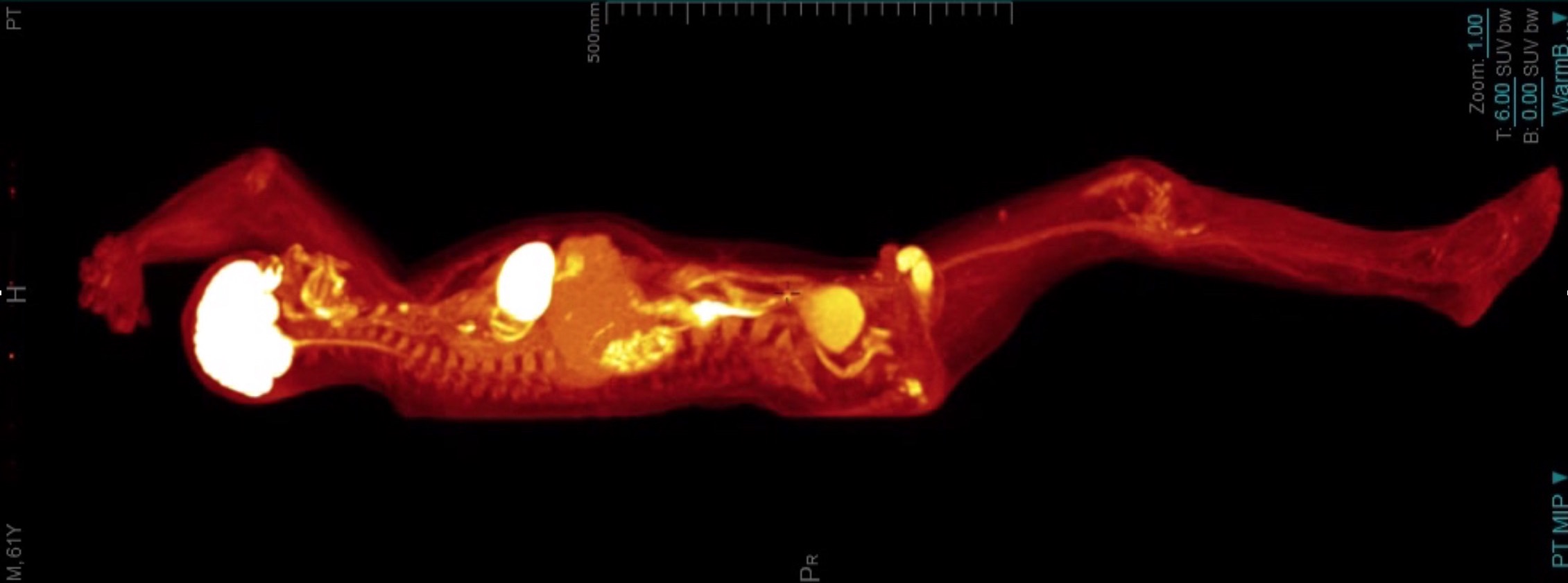 organs glow white against orange bones and red tissue in this full-body rendering