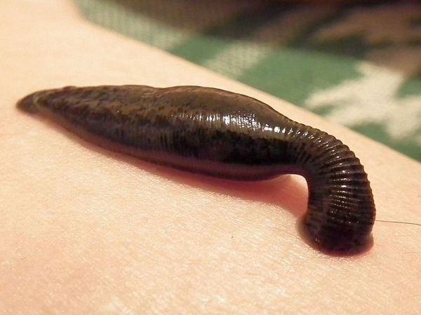 How to make sure your leech bite doesn’t kill you