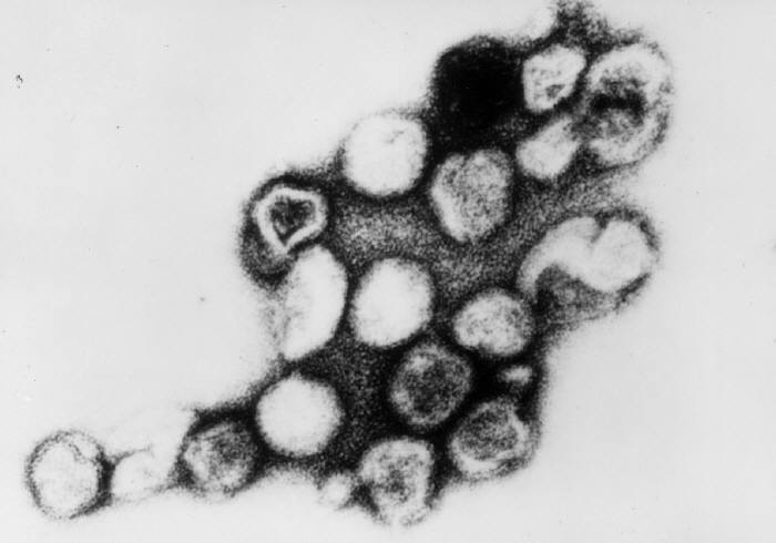 rubella virus