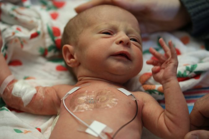 Wearable sensors designed for premature babies could make us all healthier