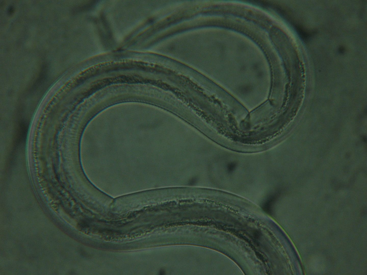 Scientists are trying to treat autoimmune disease with intestinal worms