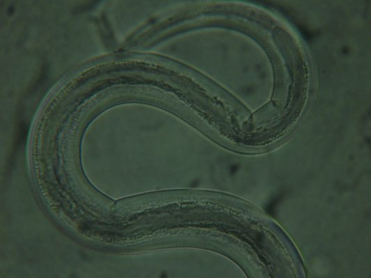 Scientists Are Trying To Treat Autoimmune Disease With Intestinal Worms