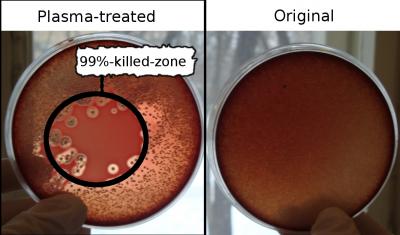 A Blast of Cold Plasma Kills Drug-Resistant Bacteria