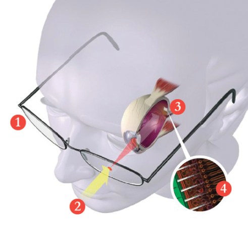 Bio-Retina Implant Could Give Laser-Powered Sight to the Blind