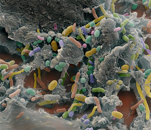 Researchers Restored A Colony Of Microbes In The Gut