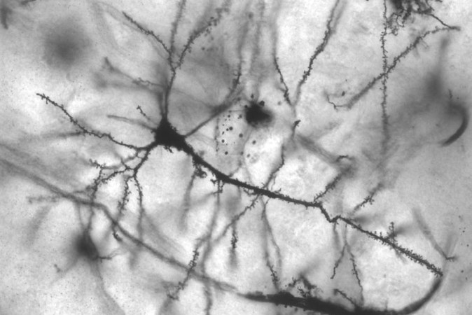 Branch-Like Dendrites Function As Mini-Computers In The Brain