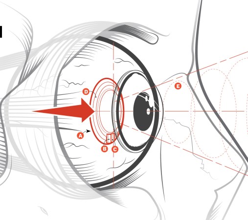 eye diagram