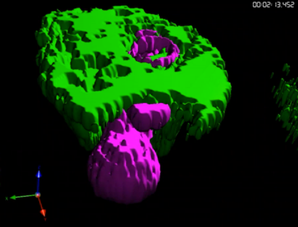 Parasitic Amoeba Eats People Alive, Bite By Bite