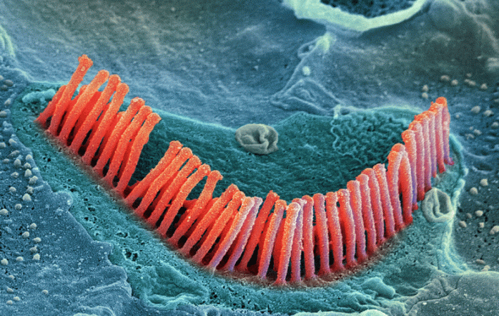 Inner ear hair cells