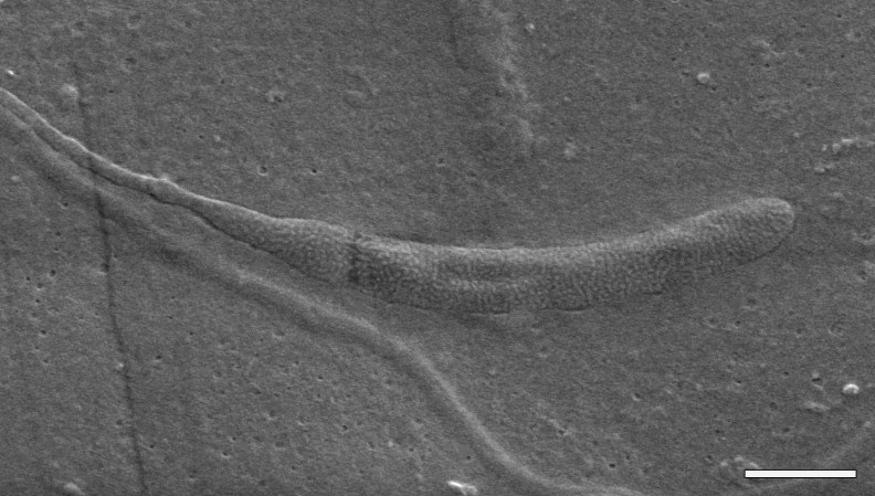 50-Million-Year-Old Worm Sperm Found Preserved In Antarctica