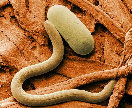 Microscopic Worms Could Sniff Out Explosives