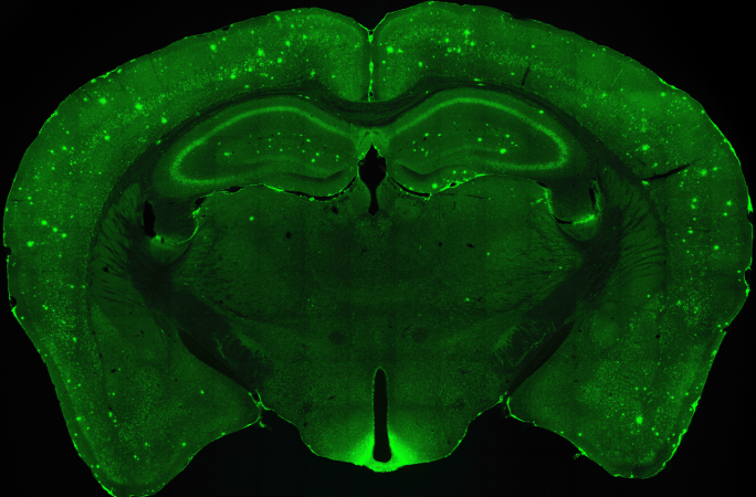 Lost Mouse Memories Found Thanks To Lasers