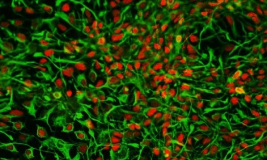 Science Can Now Turn Human Urine Into Brain Cells