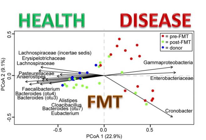 Unveiling the Hidden Movements of Fecal Transplantation