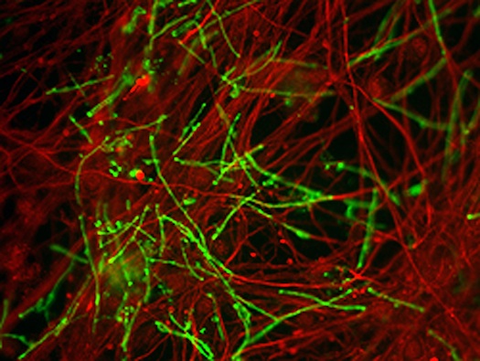 Mice Skin Cells Transformed Into Brain Cells