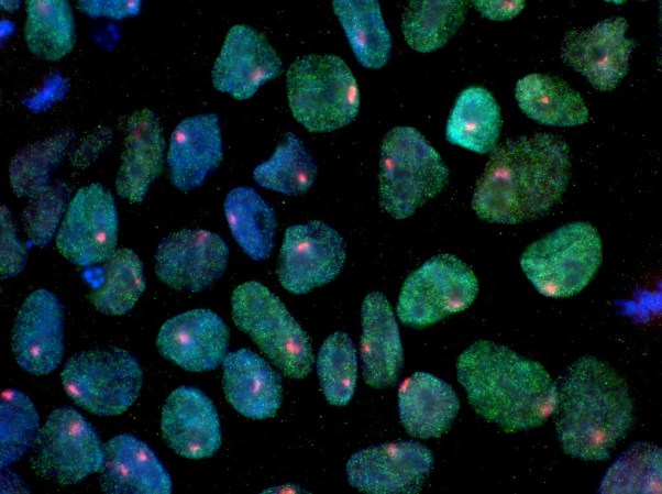 photo of induced pluripotent stem cells dyed with fluorescent dyes