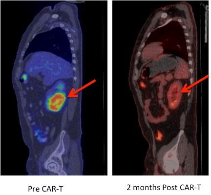 Here’s Why Scientists Are Shocked By The Results Of This Cancer Treatment Trial