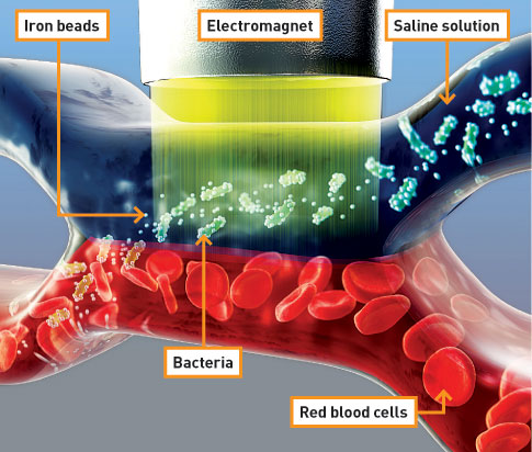 A Magnetic Machine Plucks Pathogens from Blood