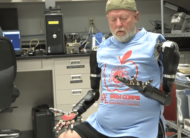 World First: Man Controls Two Prosthetic Arms With His Mind