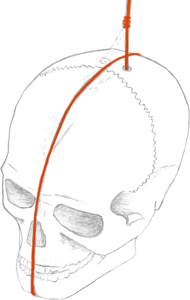 skull