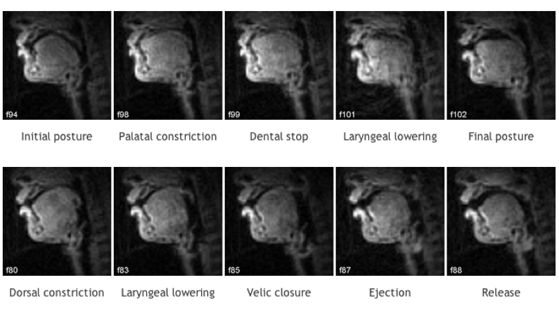 What Beatboxing Looks Like In An MRI Scan