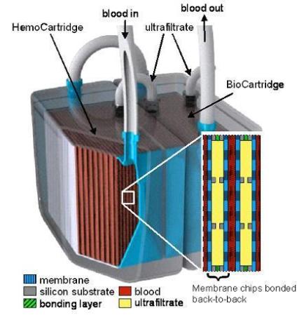 Researchers Announce First Implantable Artificial Kidney Prototype