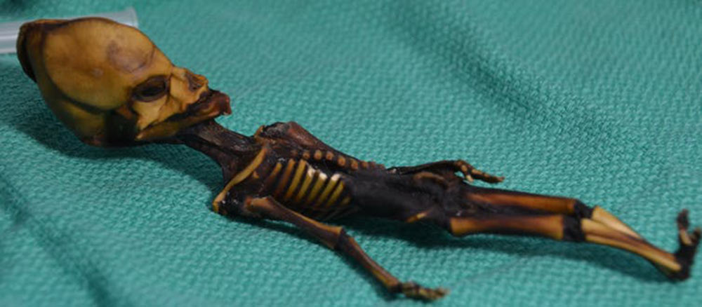 These skeletons might be evidence of the oldest known mercury poisonings