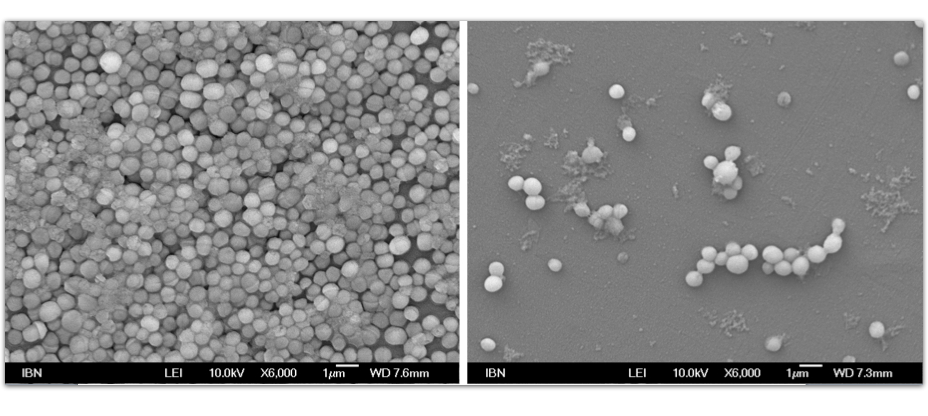 IBM’s Warmth-Activated Gel Can Break Up Tough Bacterial Biofilms And Kill Superbugs