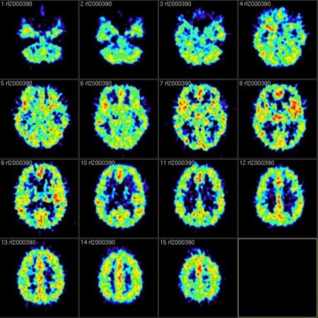 Scientists Reveal How We Can Forget On Purpose