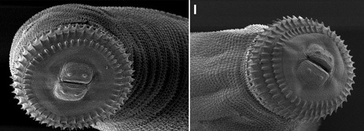 Look Into The Face Of Gnathostoma Spinigerum, A Worm That Infects Eels… And People