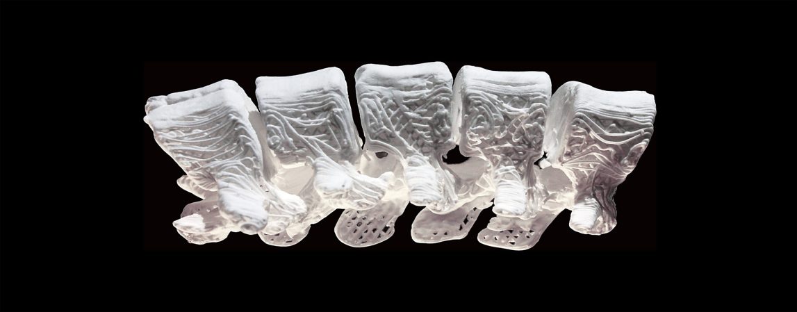 New 3D Printed Material Can Help Regenerate Bones