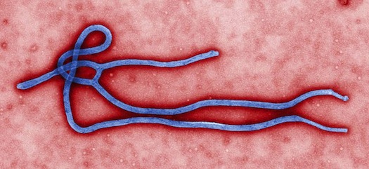 How Two Americans Got An Untested Ebola Treatment