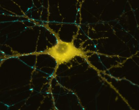 The First Artificial Nerve Cell That Uses Real Neurotransmitters