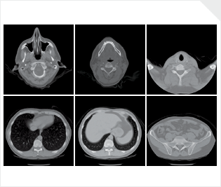 Six CT scan views