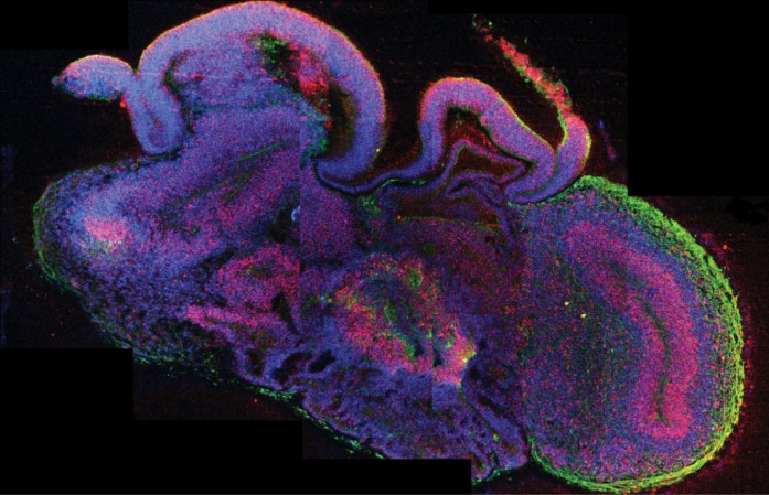 The Week In Numbers: Scientists Grow A Brain, Element 115 Exists, And More