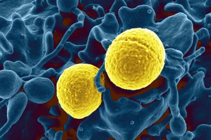 Drug-Resistant Bacteria Is No Match For…Clay From Canada?