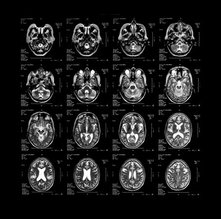 brain scans