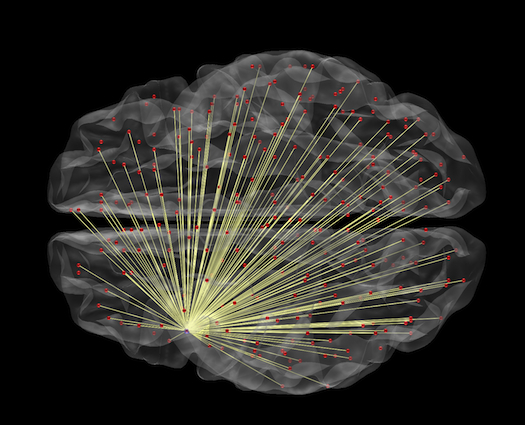 The Best Way to Measure Intelligence Could Be Brain Imaging