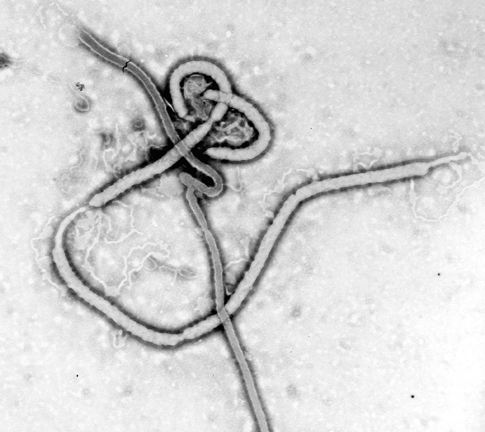 A female Ebola survivor infected her family more than a year after she had the illness