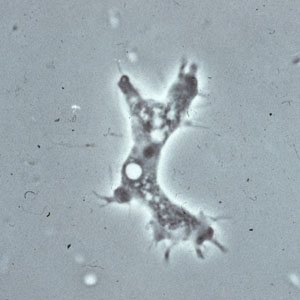 Acanthamoeba