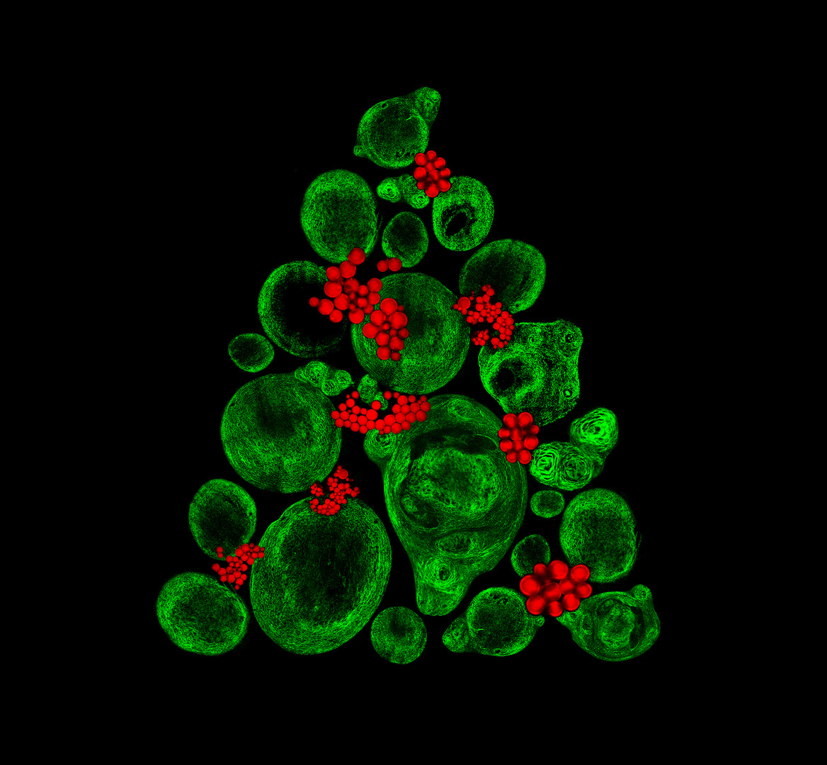 Cartilege-like tissue in the shape of a Christmas tree