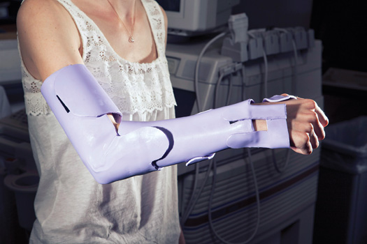 2012 Invention Awards: A Recovery-Accelerating Modular Cast