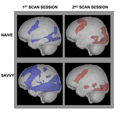 New Neurological Evidence That the Internet Makes People Smarter