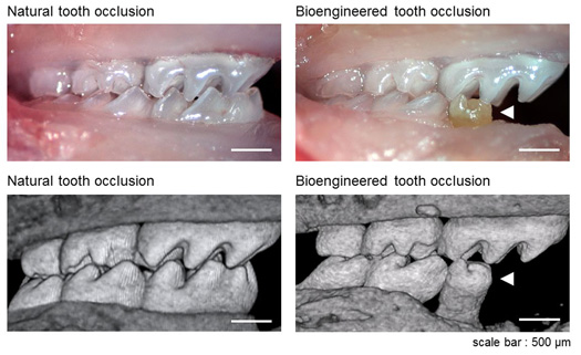 Mice Molars Grown From Stem Cells Form Fully Functional, Transplantable Teeth