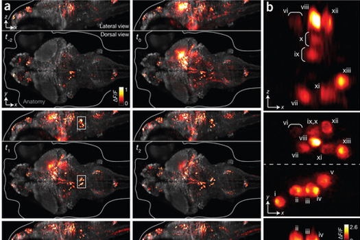 Scientists Capture All The Neurons Firing Across A Fish’s Brain On Video