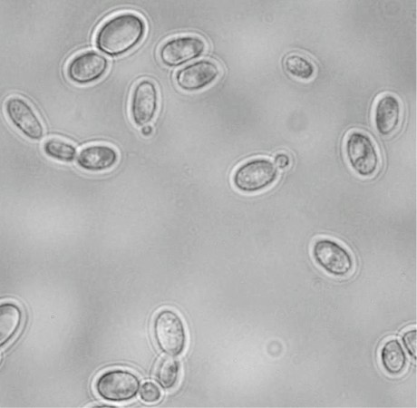 A microscopic fungus could mop up our Cold War-era nuclear waste