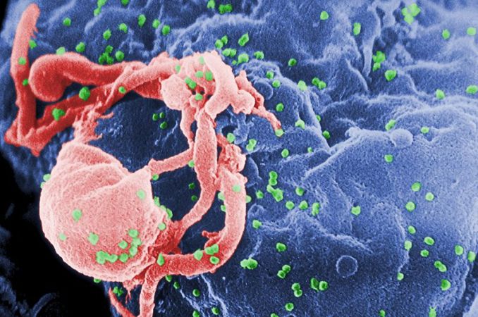 New Gene Therapy Braces T Cells Against HIV