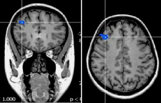 This Is What Your Brain Looks Like When You Lose Your Self-Control