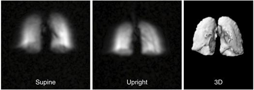 Affordable DIY MRI Shows How We Really Breathe