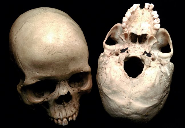 Blood-Guzzling Brain Key To Evolution Of Human Intelligence